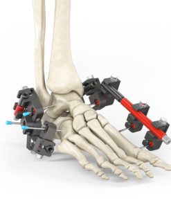 Rail and external fixator